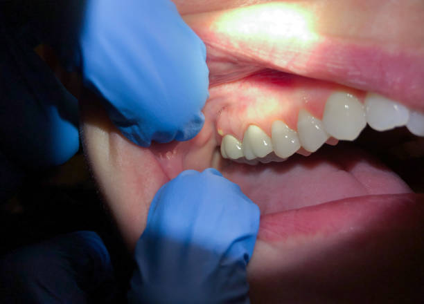 Best Mobile Emergency Dentist in Winnie, TX