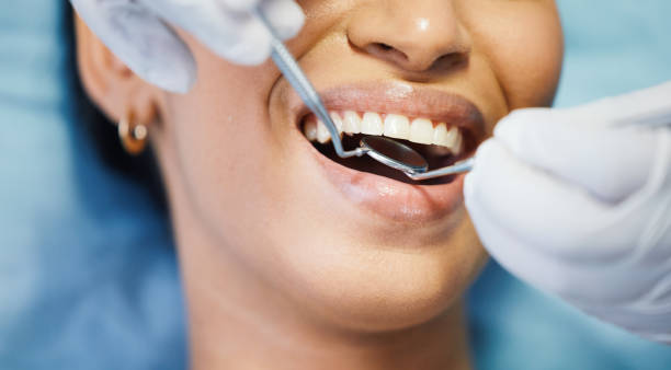 Best Broken or Cracked Tooth Emergency Dentist in Winnie, TX