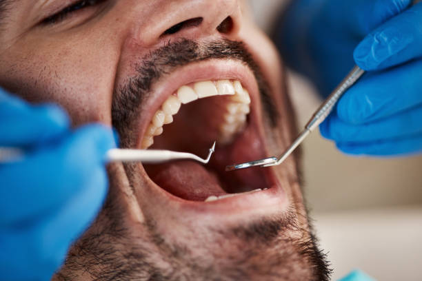 Best Emergency Dental Extractions in Winnie, TX