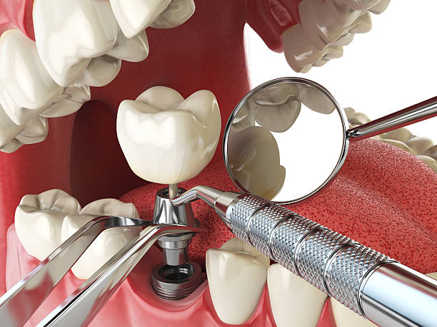 Best Emergency Dental Care for Abscessed Tooth in Winnie, TX